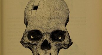 O crânio com perfuração quadrada que confirmou que os incas realizavam cirurgias complexas