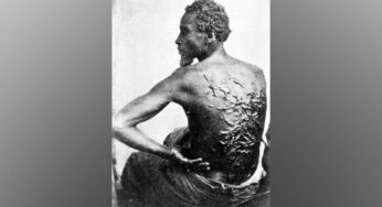 A verdadeira história de ‘Peter Chicoteado’, cuja foto mudou percepção sobre escravidão nos EUA | Pop & Arte