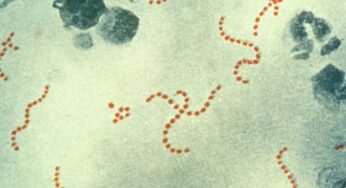 O que saber sobre infecções por Strep A entre crianças no Reino Unido